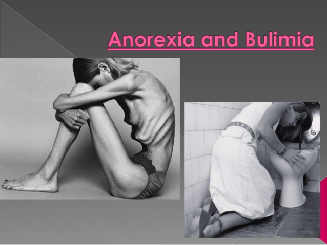 Difference between Anorexia and Bulimia - Daily Dose of My ....Anorexia vs....
